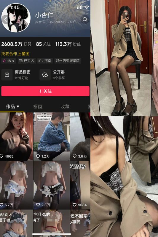 抖音 小杏仁 微密圈  NO.007 【61P】最新至：2025.3.10-微密来-