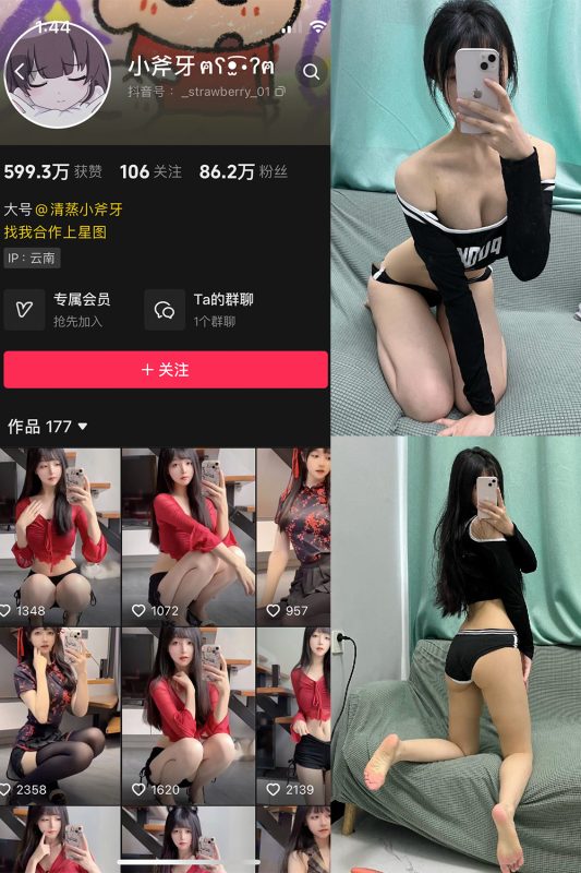 抖音 清蒸小斧牙 VIP 微密圈  NO.003期 【25P】最新至：2024.8.3-微密来-