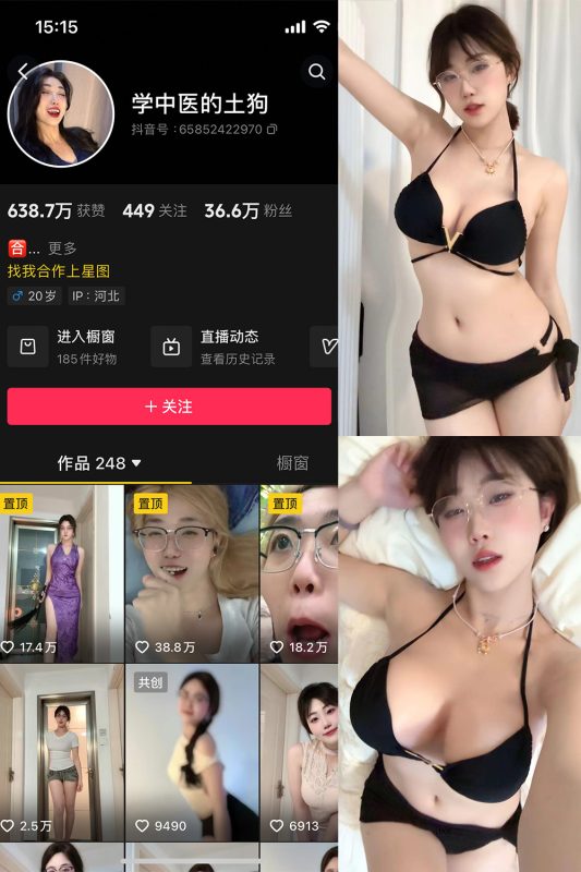 抖音 学中医的土狗 微密圈  NO.002期 【11P1V】最新至：2024.4.18-微密来-